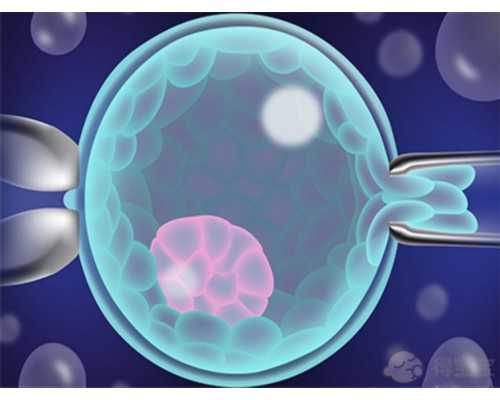 治疗卵巢癌的四大法宝：让生活重焕光彩！